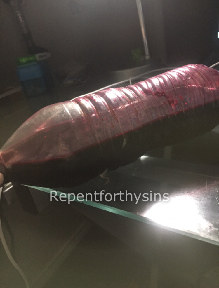 Flesh removed from my body.