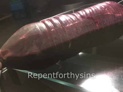 Flesh removed from my body