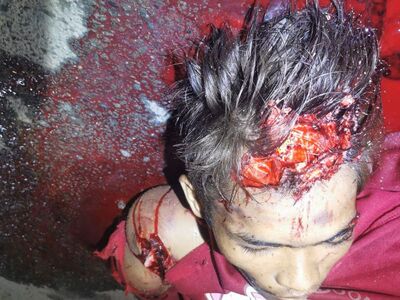 Teen on a Motorbike Collided with an Electric Tricycle