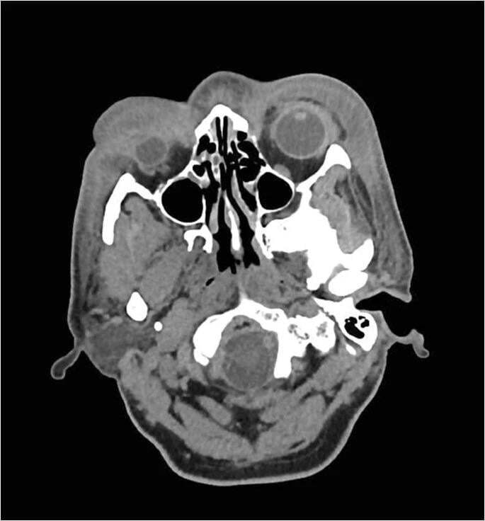 Man attacked with a plank