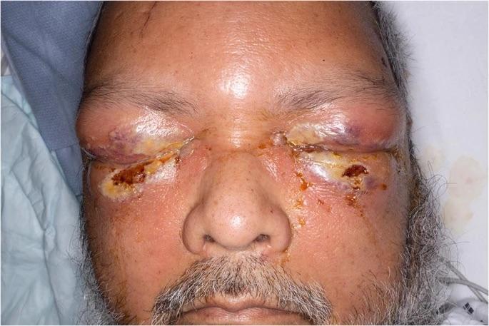 Man attacked with a plank