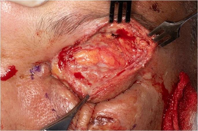 Man attacked with a plank