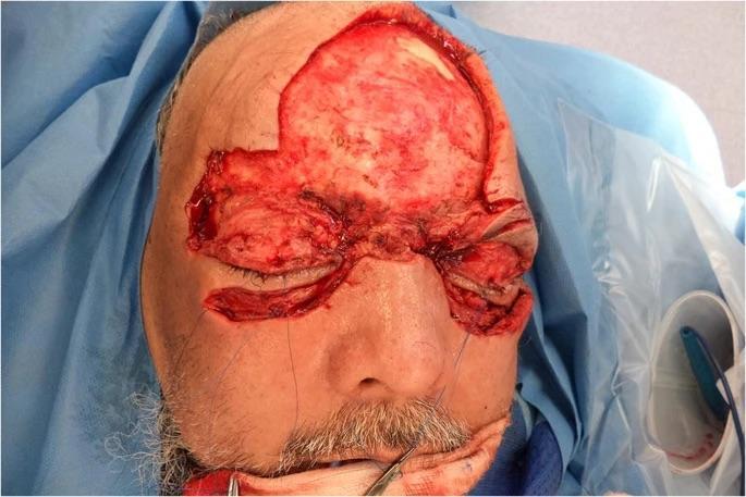 Man attacked with a plank