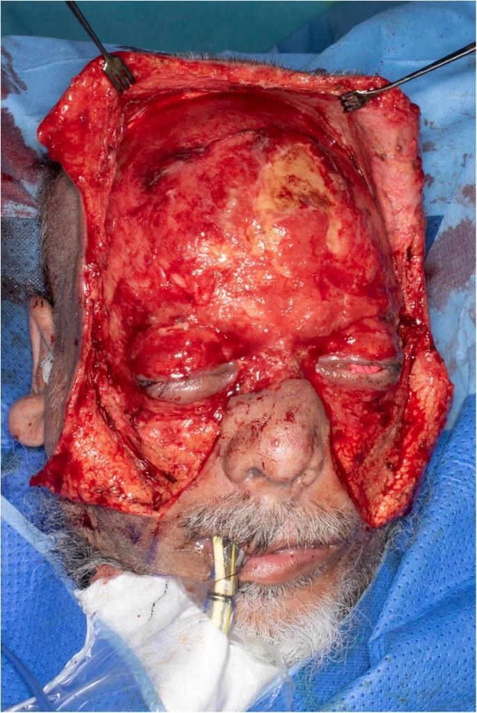 Man attacked with a plank