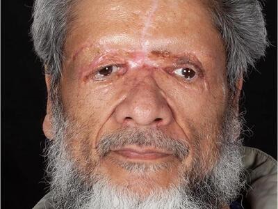 Man attacked with a plank