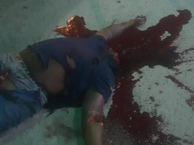 Brazil- Car Accident Resulting In decapitation.