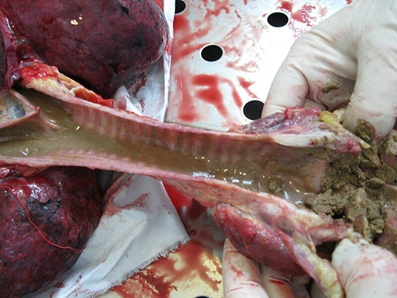 Autopsy of Man Who Suffocated in a Ditch