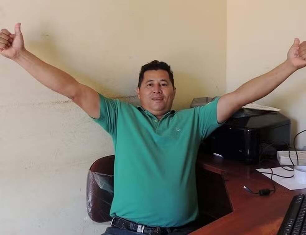 Brazil- Naldo suffered from a necrotizing skin condition died at 30.