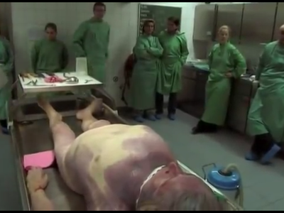 German Man died at home and was taken to morgue for autopsy