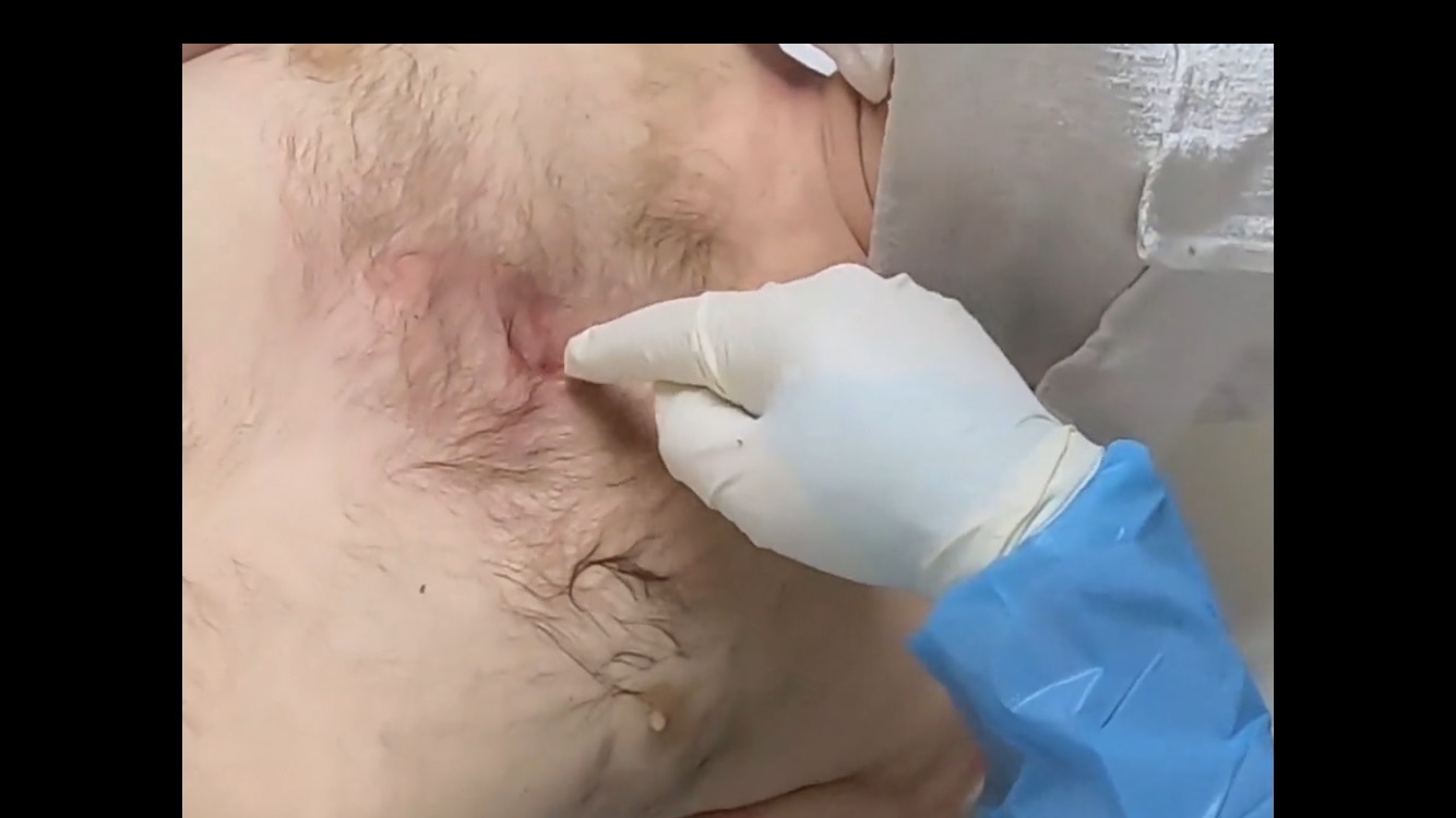 Polish Truck driver examinated at morgue