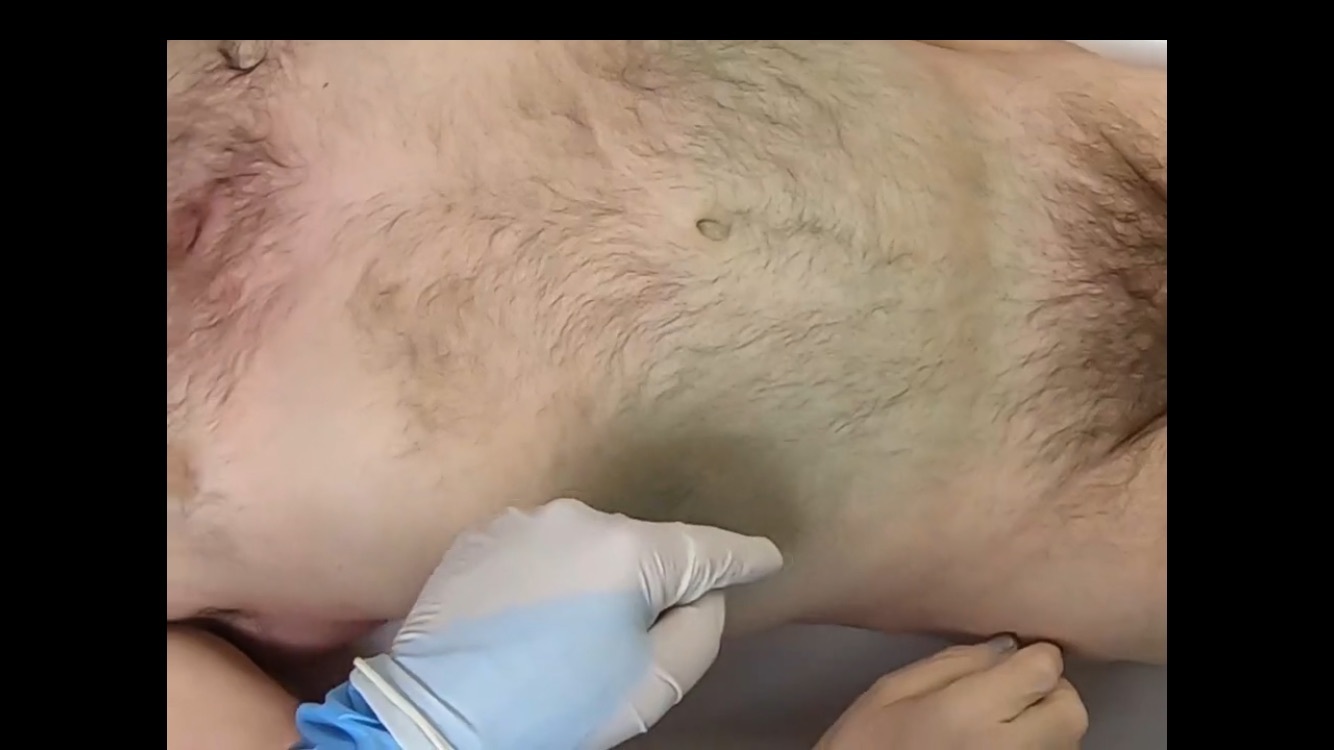 Polish Truck driver examinated at morgue