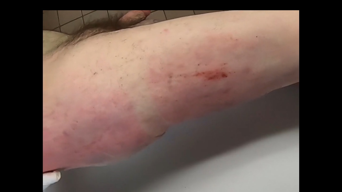 Polish Truck driver examinated at morgue