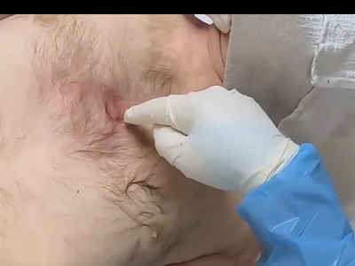 Polish Truck driver examinated at morgue