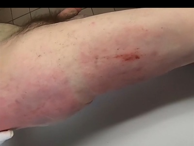 Polish Truck driver examinated at morgue