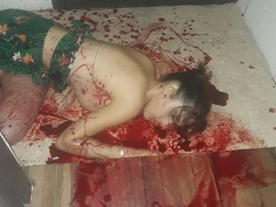 Venezuelan Escort Killed In Mexican Motel Room