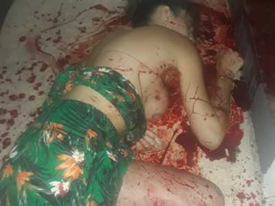 Venezuelan Escort Killed In Mexican Motel Room