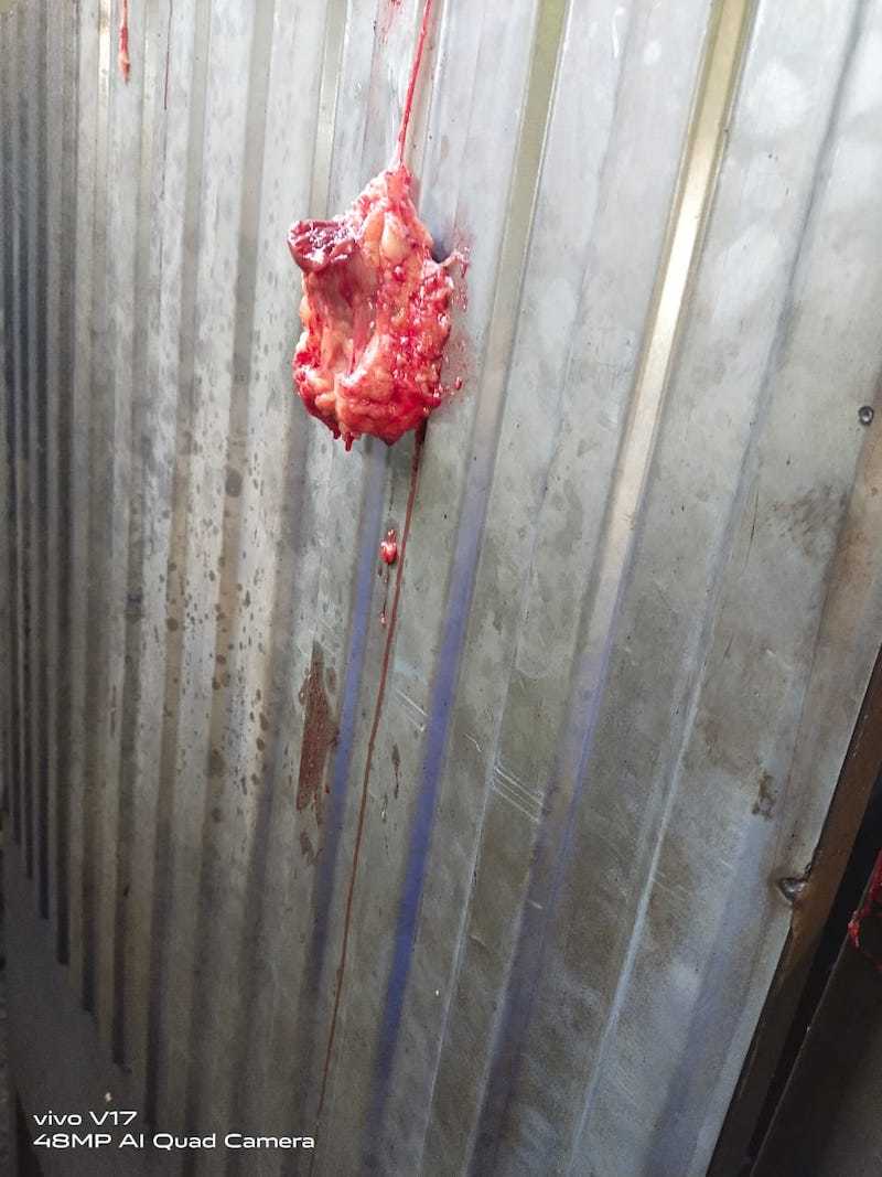 Aftermath pictures of man pulled into lathe