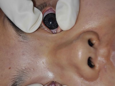 Autposy: Young asian female examined