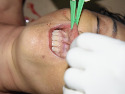 Chinese female found naked on the floor(examined)