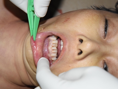 Chinese female found naked on the floor(examined)