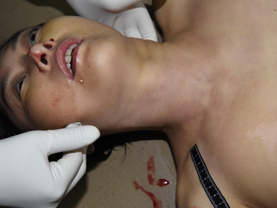 Chinese female found naked on the floor(examined)