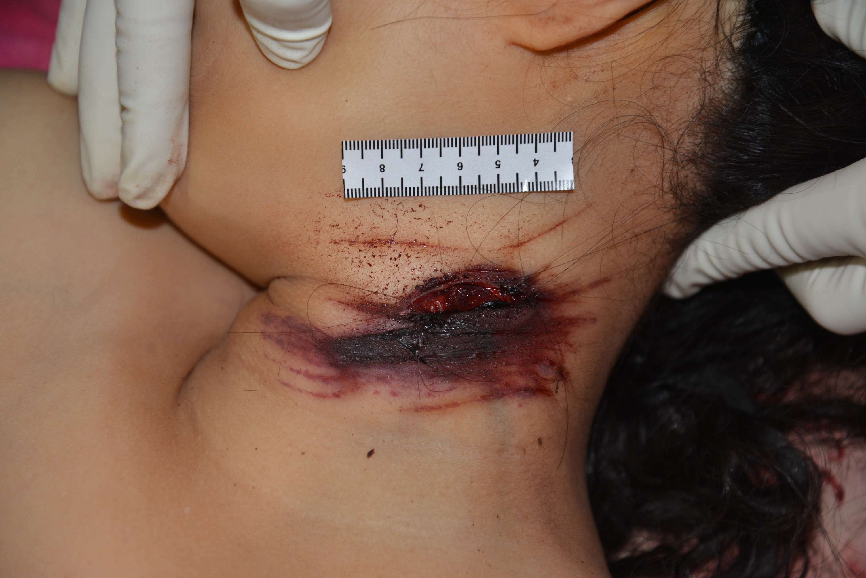 Chinese Mistress Stabbed To Death By Lover.