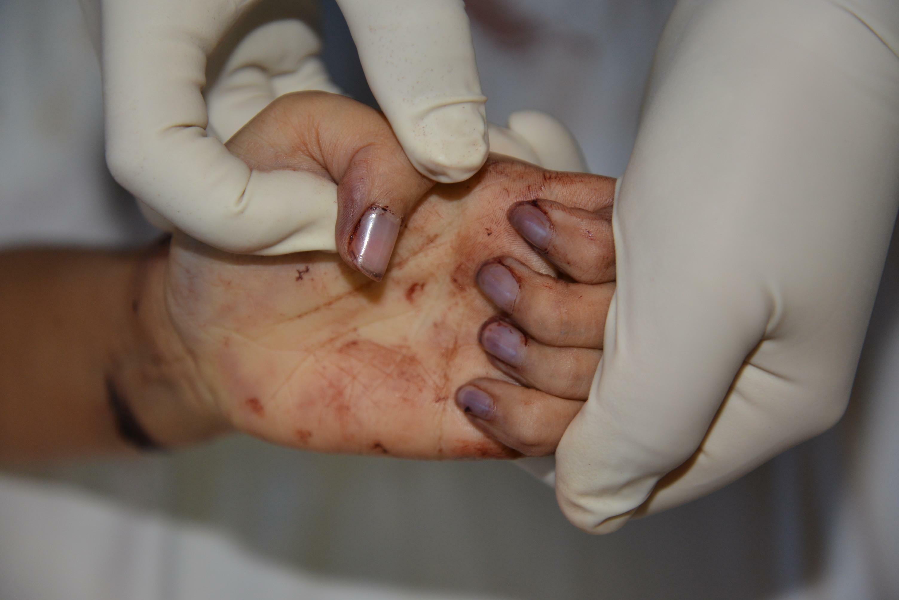 Chinese Mistress Stabbed To Death By Lover.