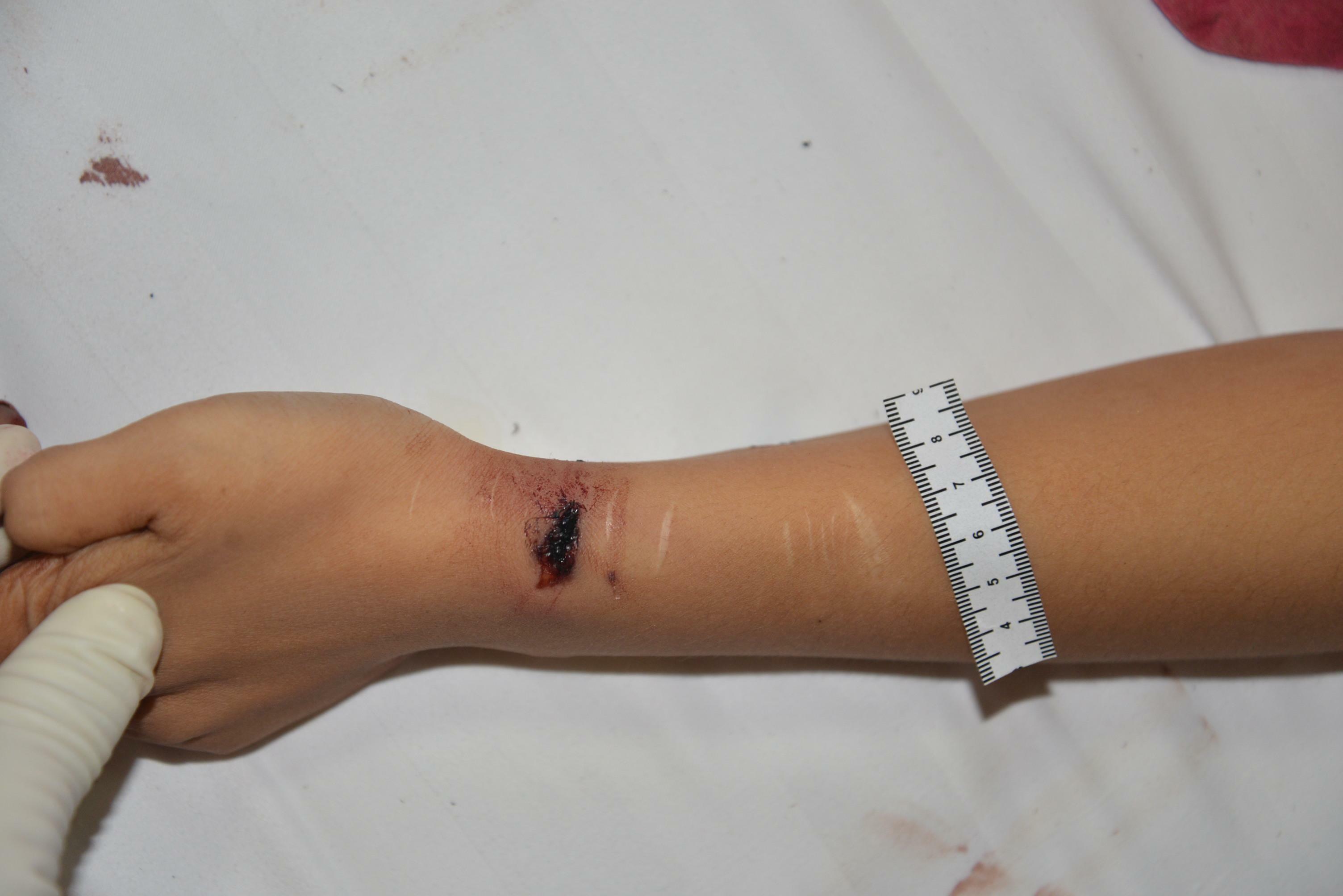 Chinese Mistress Stabbed To Death By Lover.