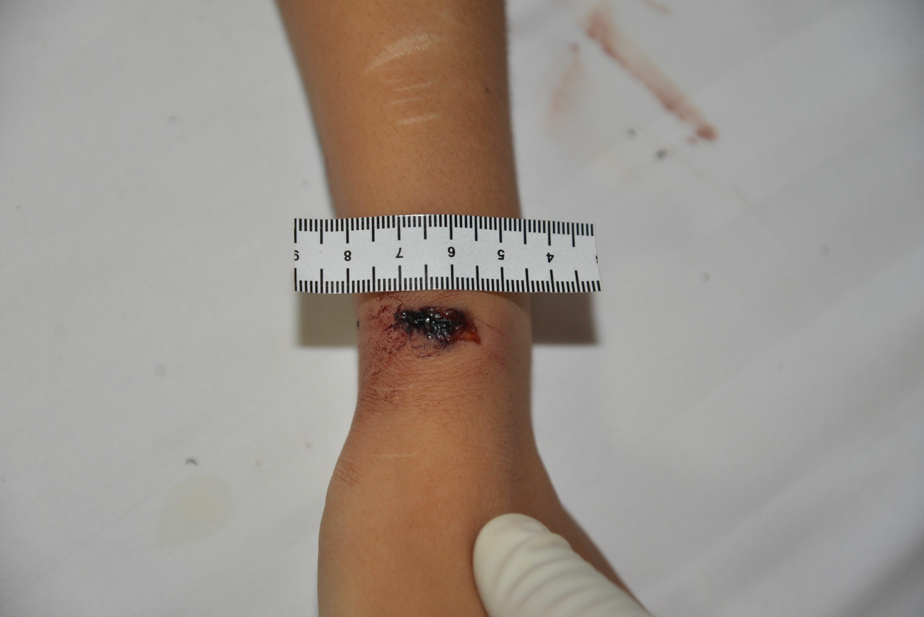 Chinese Mistress Stabbed To Death By Lover.