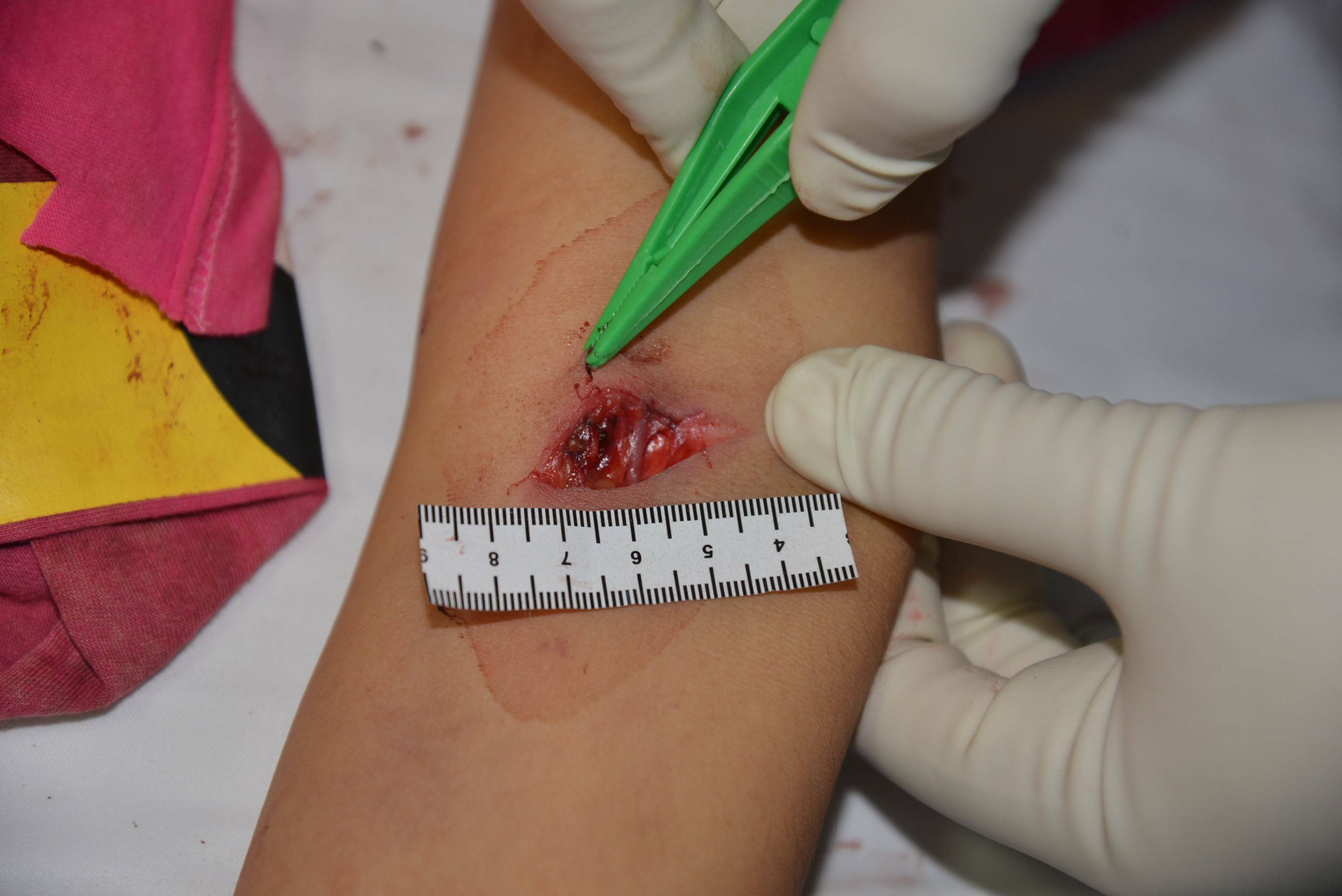 Chinese Mistress Stabbed To Death By Lover.