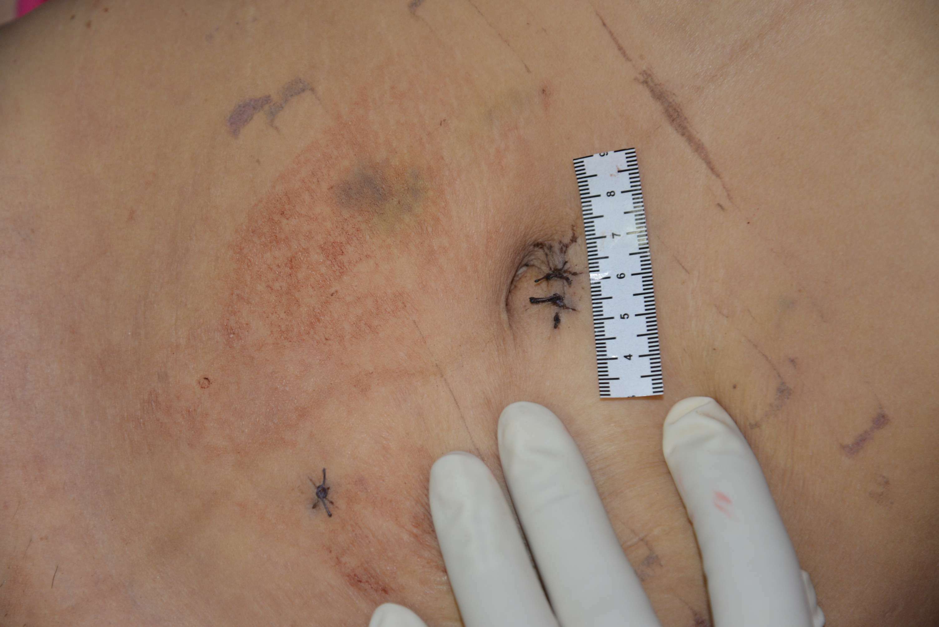 Chinese Mistress Stabbed To Death By Lover.