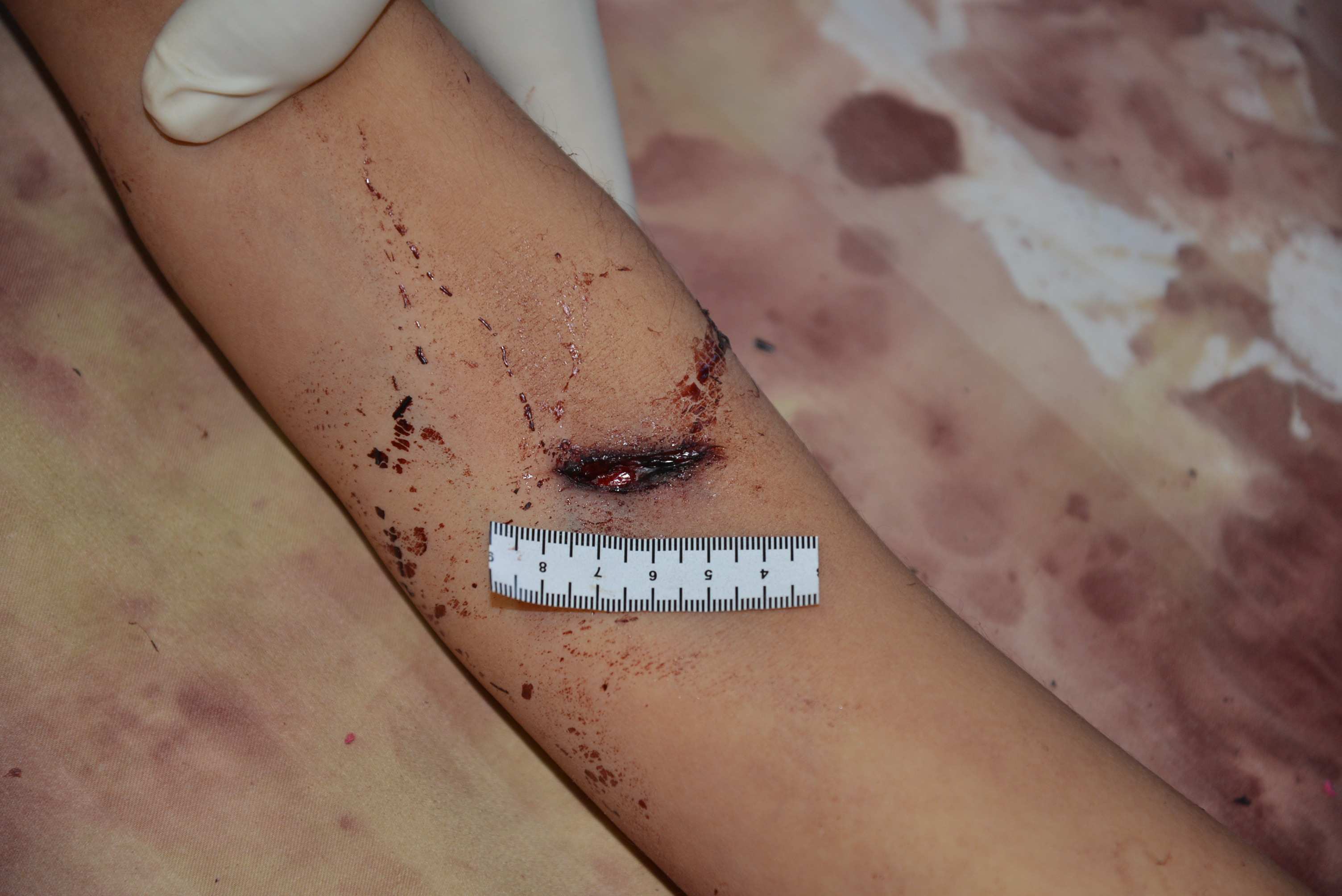 Chinese Mistress Stabbed To Death By Lover.