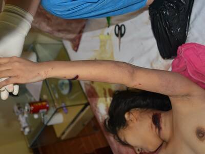 Chinese Mistress Stabbed To Death By Lover.