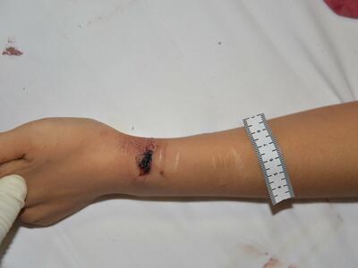 Chinese Mistress Stabbed To Death By Lover.