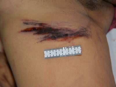 Chinese Mistress Stabbed To Death By Lover.