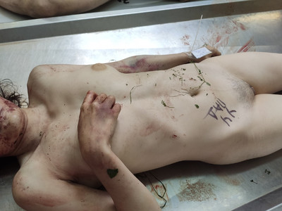 Morgue: woman ready to be dissected