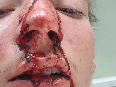 THIS is my Friend After car crash