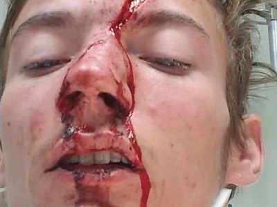 THIS is my Friend After car crash