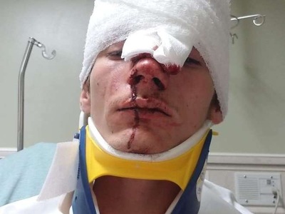 THIS is my Friend After car crash