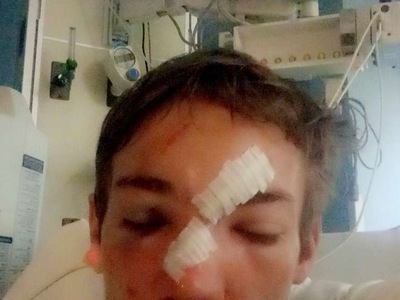 THIS is my Friend After car crash