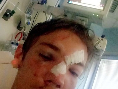 THIS is my Friend After car crash