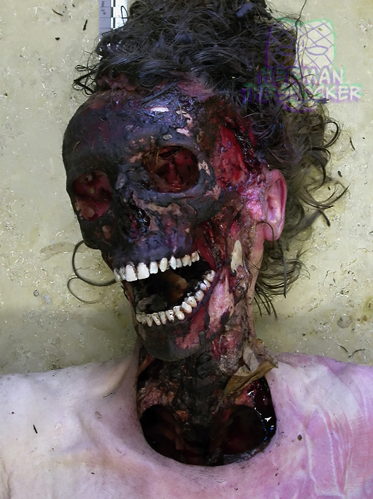 Skeletonization Of The Head