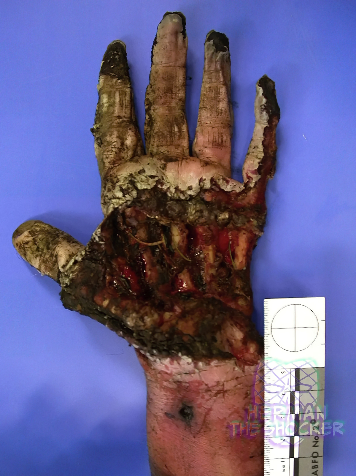 Skeletonization Of The Head