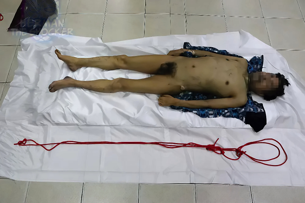 Self-Ligature Strangulation By Utilizing A Recliner