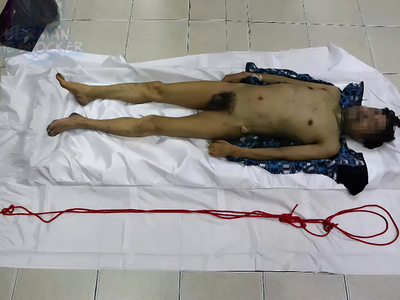 Self-Ligature Strangulation By Utilizing A Recliner