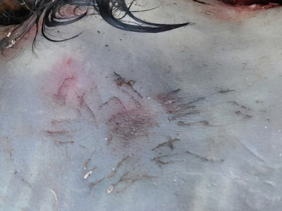 Rac Scavenging On A Human Corpse