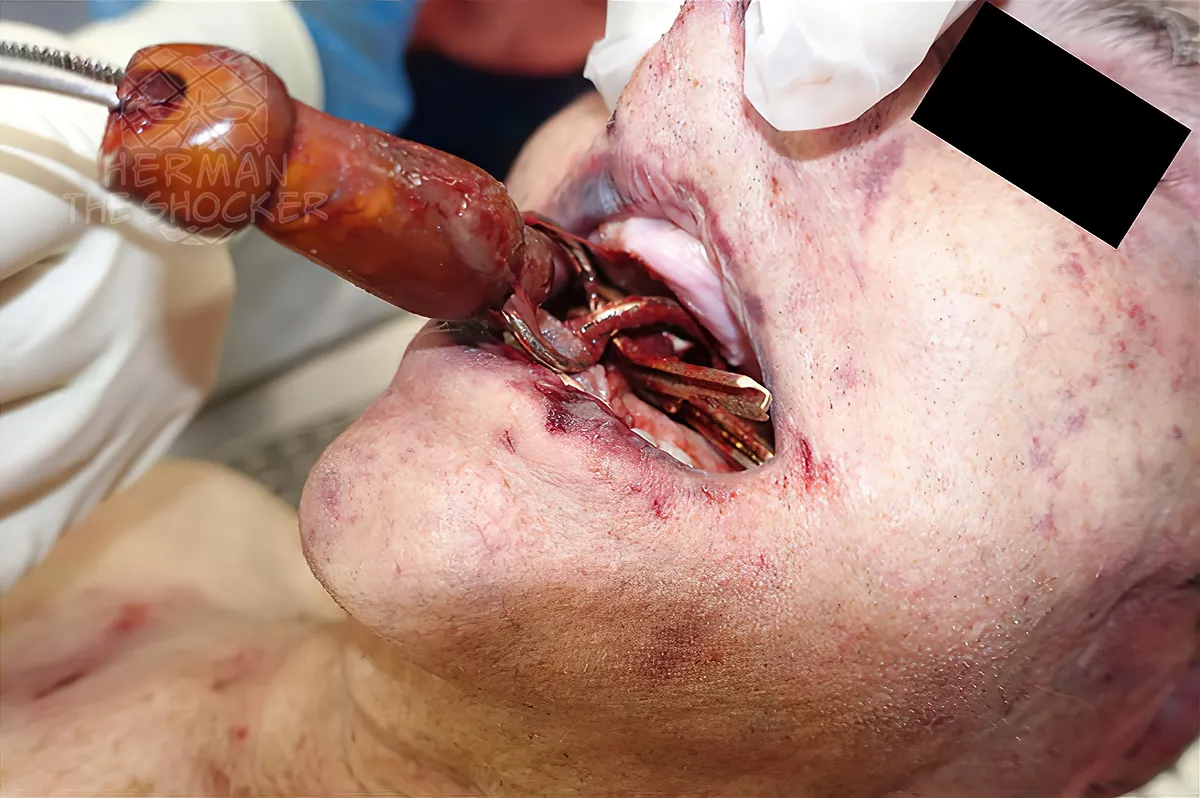 Patricide And Overkill