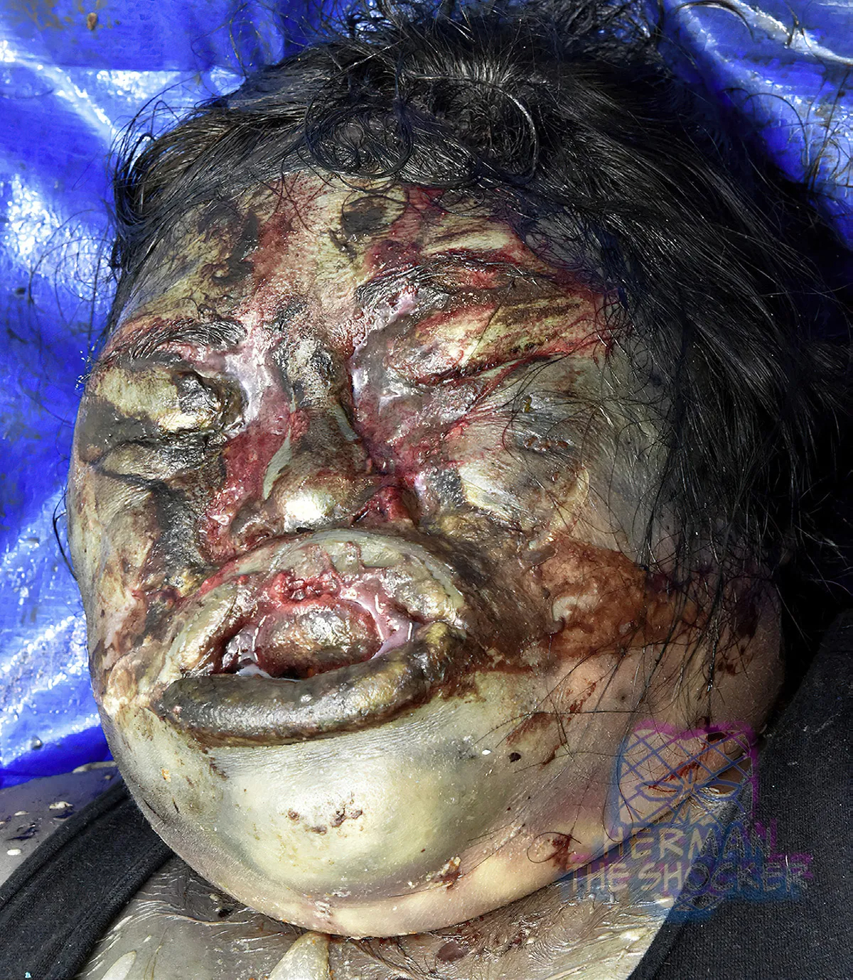 An elderly woman in a state of advanced decomposition