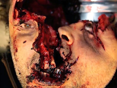 Shotgun Blast To The Head