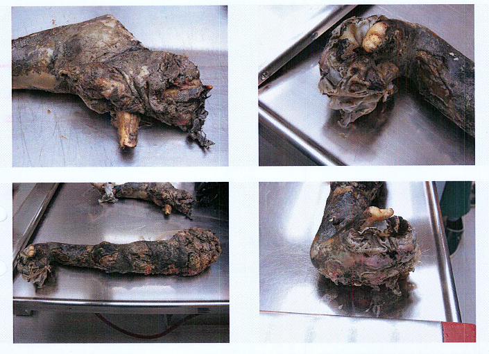 Autopsy images from Christian Larsson case